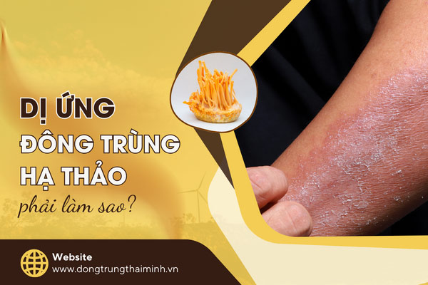 Dị ứng đông trùng hạ thảo phải làm sao? 5 ...